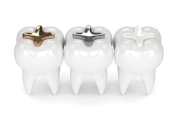 Dental Filling treatment in dharashiv osmanabad
