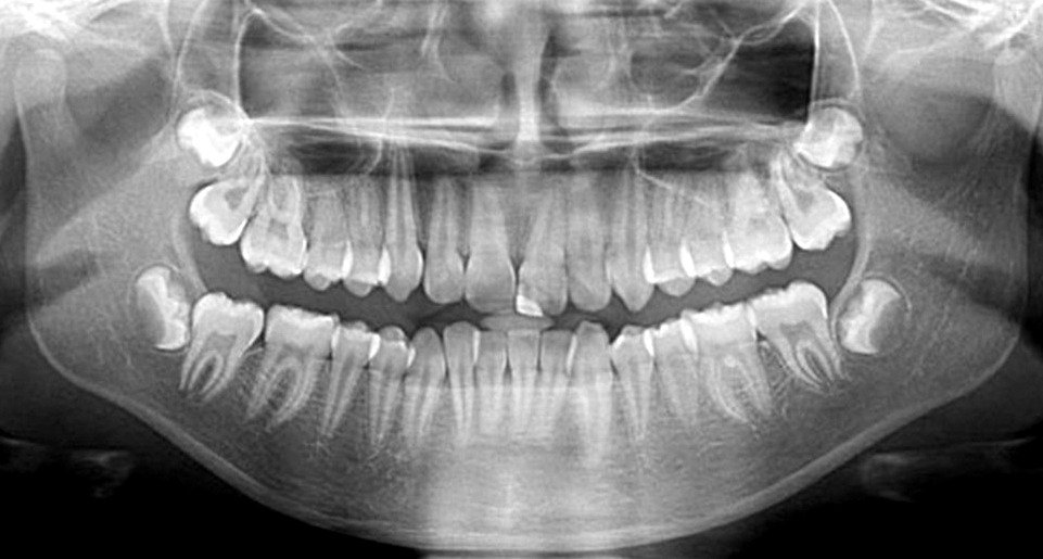 Dental X-Ray Dharashiv