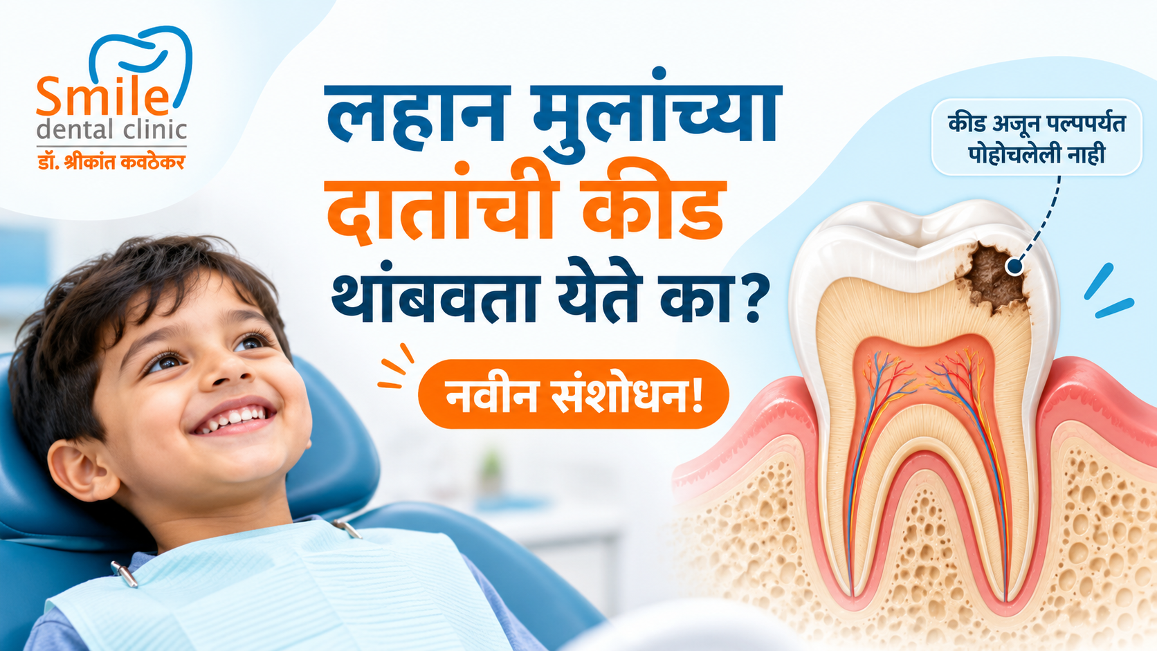 लहान मुलांच्या दातांची कीड थांबवता येते का? – नवीन संशोधन!