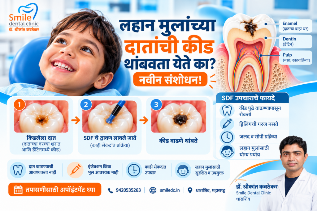 Dental Caries treatment in children. Dentist Dharashiv
